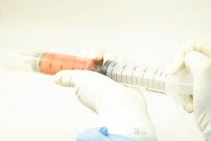 コンデンスリッチの脂肪